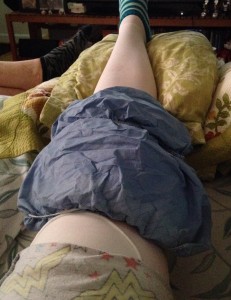 My left knee directly after surgery accompanied by ice packs. 